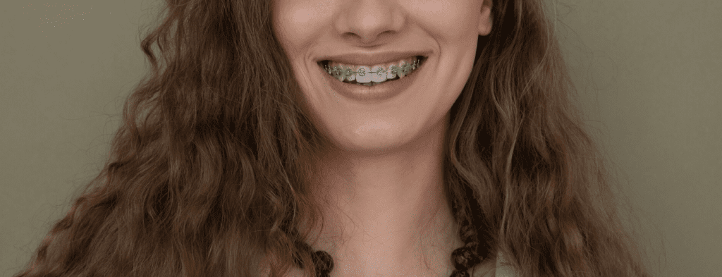 Can Adults Get Braces? Embrace a New Smile at Any Age!